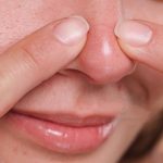 12 Tips to Get Rid of Whiteheads on Nose Whiteheads on Nose