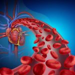 Home Remedies to Improve Blood Circulation Home Remedies to Improve Blood Circulation