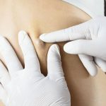 How to Drain a Cyst With No Head? How to Drain a Cyst With No Head