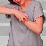 Home Remedies for Scabies