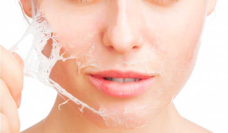 Home Remedies for Peeling Skin