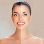 How to Remove Tan from Face: 12 Best Home Remedies for Sun Tan How to Remove Tan from Face