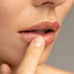 How to Get Rid of Blackheads on Lips? how to get rid of blackheads on lips
