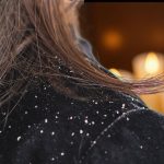 What Are The Best Essential Oils For Dandruff? Essential Oils For Dandruff