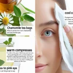 Home Remedies for Pink Eye Home Remedies for Pink Eye
