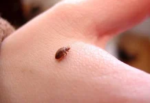 How to Get Rid of Bed Bug Bites and What This Means to The World How to Get Rid of Bed Bug Bites