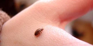 How to Get Rid of Bed Bug Bites and What This Means to The World How to Get Rid of Bed Bug Bites