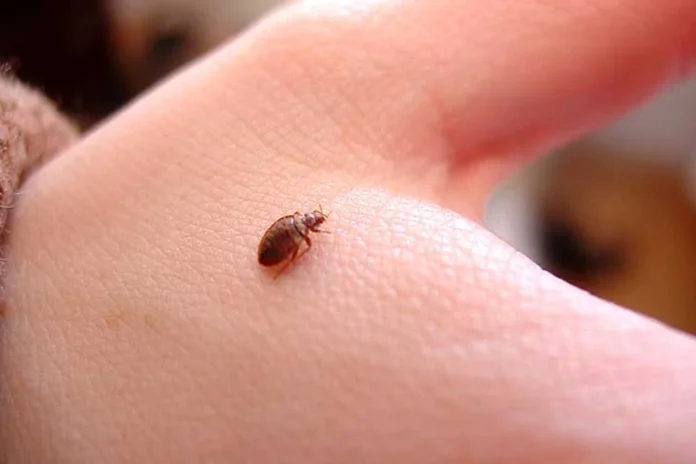 How to Get Rid of Bed Bug Bites