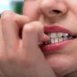 How to Stop Nail Biting How to Stop Nail Biting