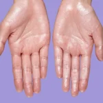 How to Stop Sweaty Hands – A Critical Guide Few People Know How to Stop Sweaty Hands