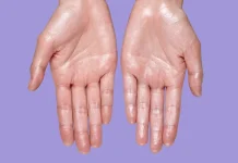 How to Stop Sweaty Hands – A Critical Guide Few People Know How to Stop Sweaty Hands