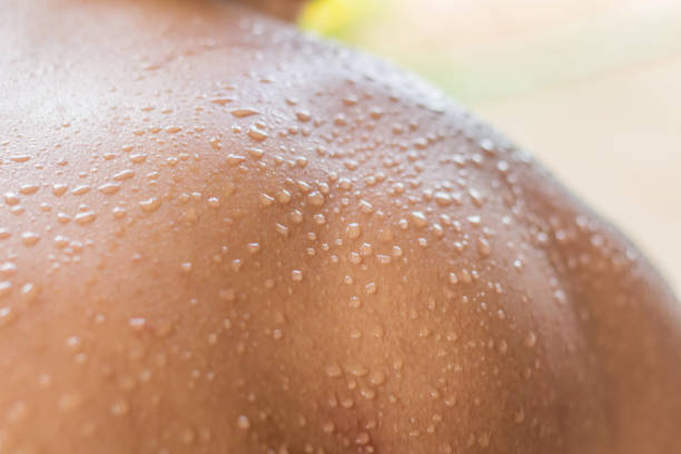 What Causes Excessive Sweating