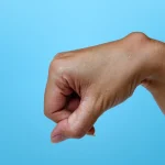 How to Treat a Ganglion Cyst How to Treat a Ganglion Cyst