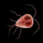 What Is Giardiasis? What Is Giardiasis
