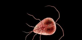 What Is Giardiasis? What Is Giardiasis