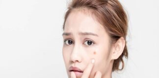 Top 5 Tips To Acne Treatment Acne Treatment