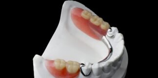 Benefits You Get With Partial Dentures partial dentures