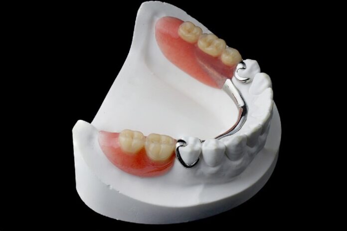 Partial-dentures partial dentures