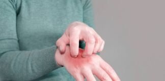 Scabies Treatment and Management Scabies Treatment