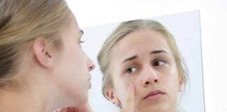 Top 10 Home Remedies For Acne Home Remedies For Acne