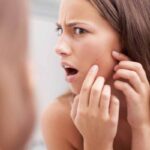 How to Get Rid of Blackheads on Cheeks Safely and Efficiently get rid of blackheads